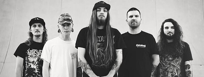 Vulvodynia
